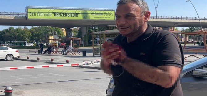 350 kişi Kayseri'de hastaneye başvurdu, çoğu ayakta tedavi edildi