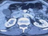 İranlı şüphelilerin midelerinde uyuşturucu tespit edildi; 3 gözaltı