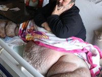 5 Yıldır evden çıkamıyor 300 kiloya ulaştı