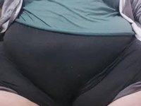 Kayseri'de 300 kiloya ulaşan fil hastası Engin, tedavi için Ankara'ya götürüldü 